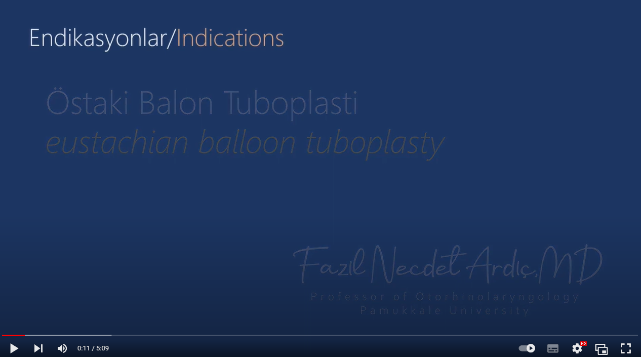 Östaki Balon Tuboplasti (eustachian balloon tuboplasty)